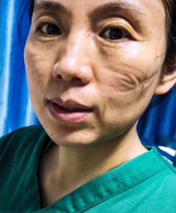 武汉疫情的开始时间及其影响